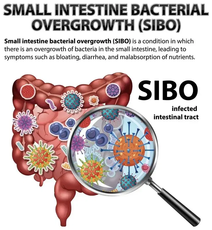 Understanding SIBO Symptoms Causes and Effective Solutions