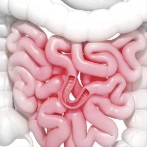 Intestinal Obstruction